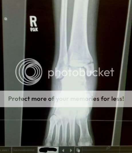 xray2.jpg